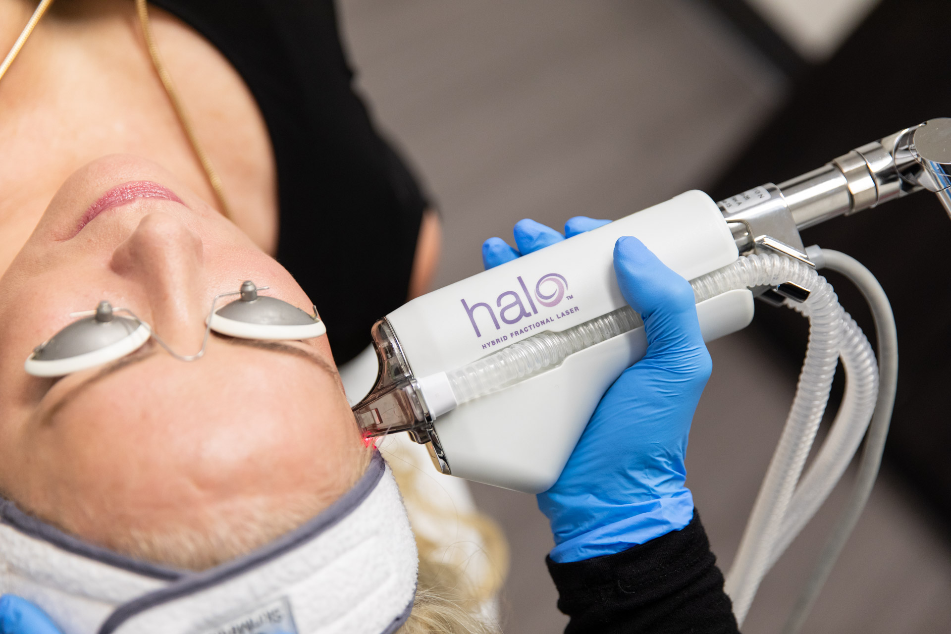 A woman receives HALO, a low downtime laser treatment in Houston
