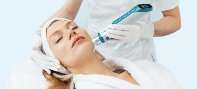 Microneedling Houston