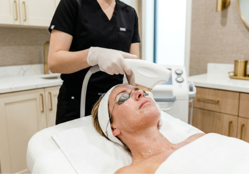 Bbl Hero treatment in progress at Ovation Med Spa