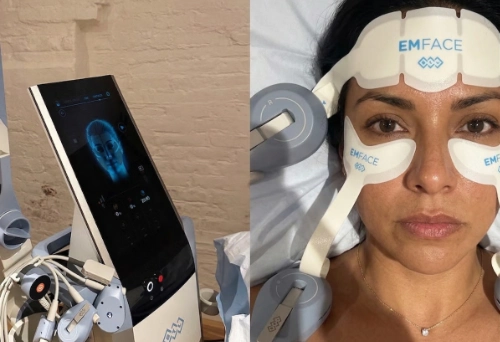 Emface treatment in progress at Ovation Med Spa