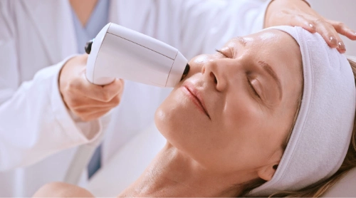 Sofwave treatment in progress at Ovation Med Spa